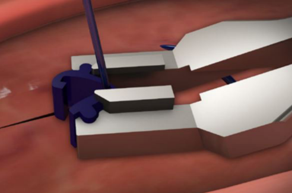 Biocompatibility of medical devices - surgical equipment